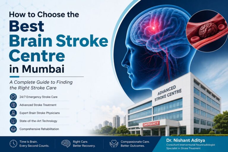 Best Brain Stroke Centre in Mumbai