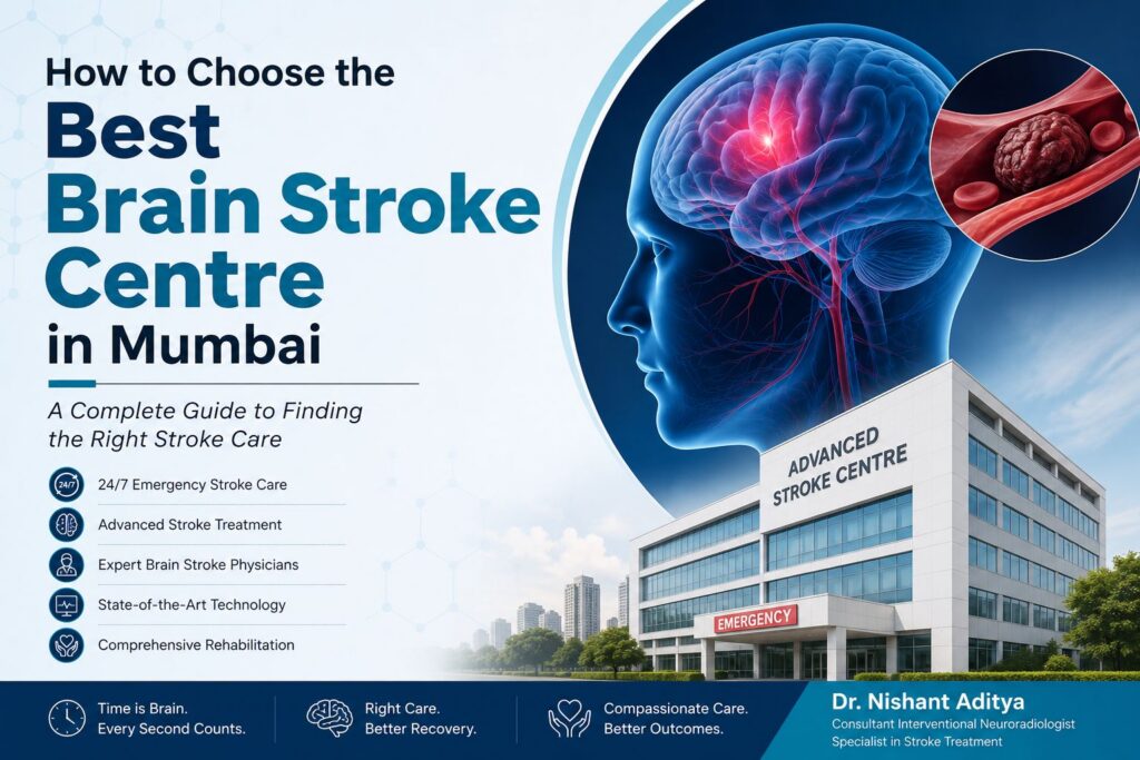 best brain stroke centre in Mumbai