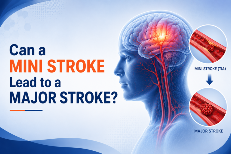 Can a Mini Stroke Lead to a Major Stroke?