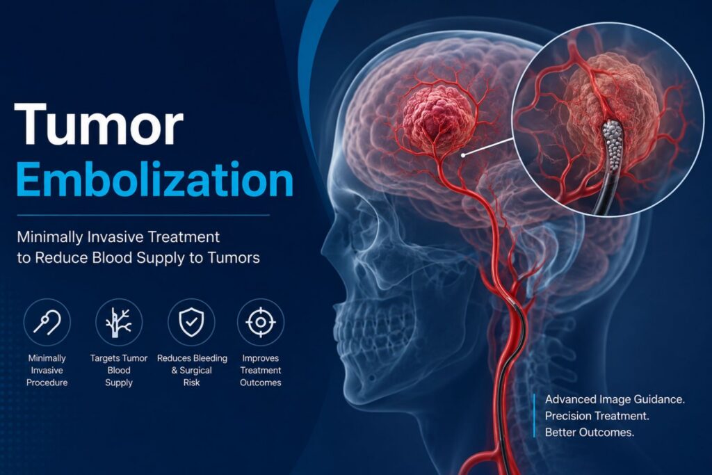 Tumor Embolization